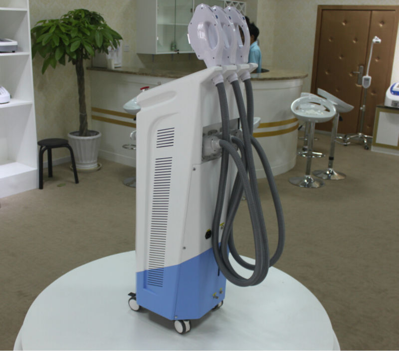 Best Selling IPL Hair Removal/Skin Rejuvenation/Vascular Removal Machine NBW-I323