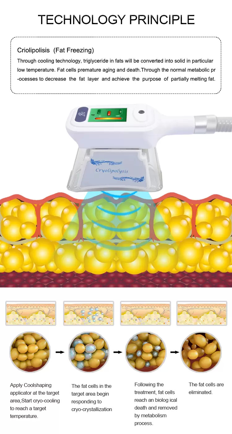 Professional Fat Freezing Cryolipolysis Machine Slimming Weight Loss Fat Reduction