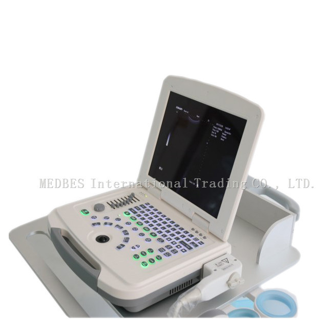 Professional Ultrasound Imaging System 15 Inch LED Laptop Hospital Machine