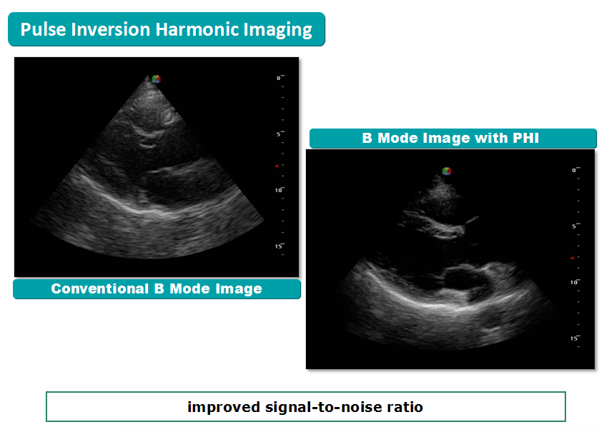 Trolley 4d Color Doppler Ultrasound Ecografo Sonoscape S50 Ultrasound