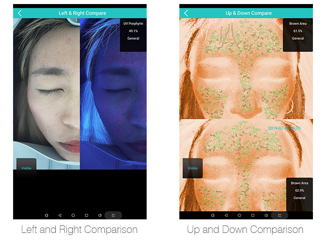 Android System Skin Analysis Machine Salon Big Data Base 3D Testing Facial