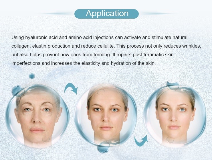 Disposable 9 Pin Needle For Mesogun Injection Anti Aging Anti Wrinkle Skin Booster