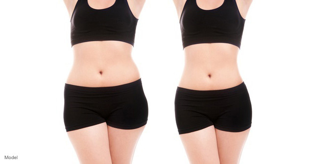 3 In 1 Cryolipolysis Slimming Machine For Transfer Fat And Tighten Skin