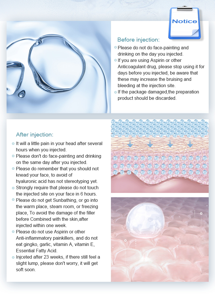 Pure Cross Linked Hyaluronic Acid Dermal Filler