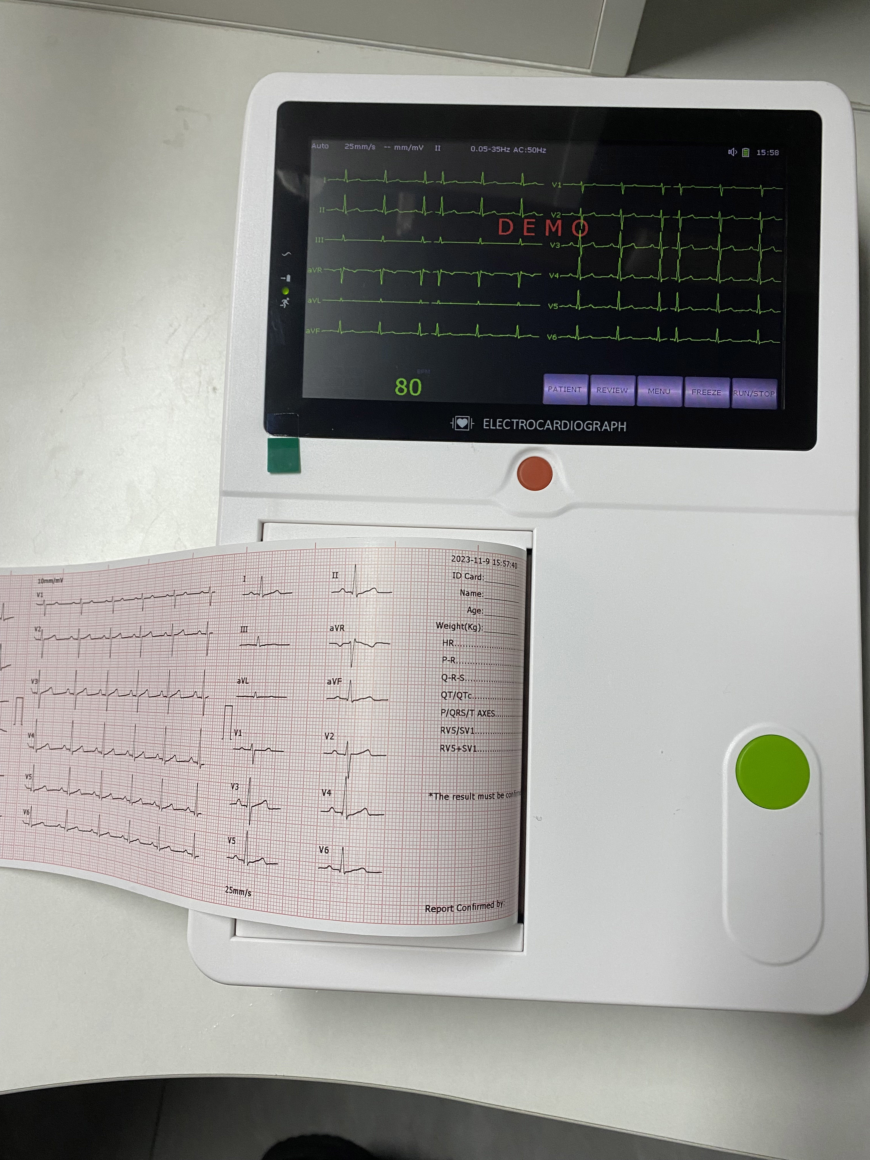 6 Channel Digital ECG Machine Factory Price Monitor For Hospital