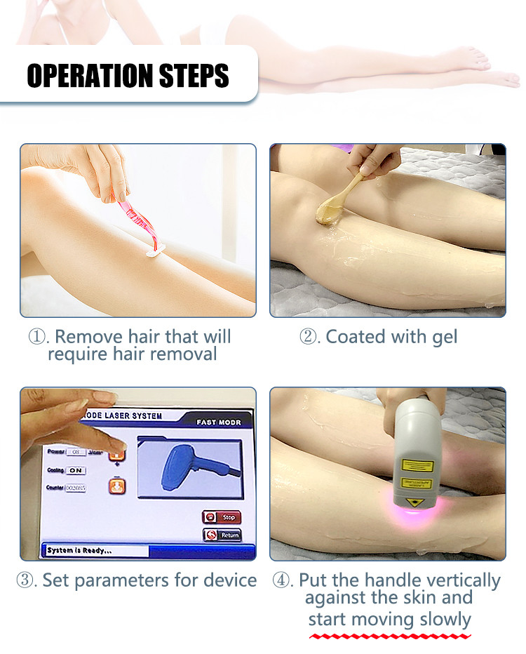 hot selling 1200W diode laser 808nm hair removal machine/Germany laser 6 bars hair removal device