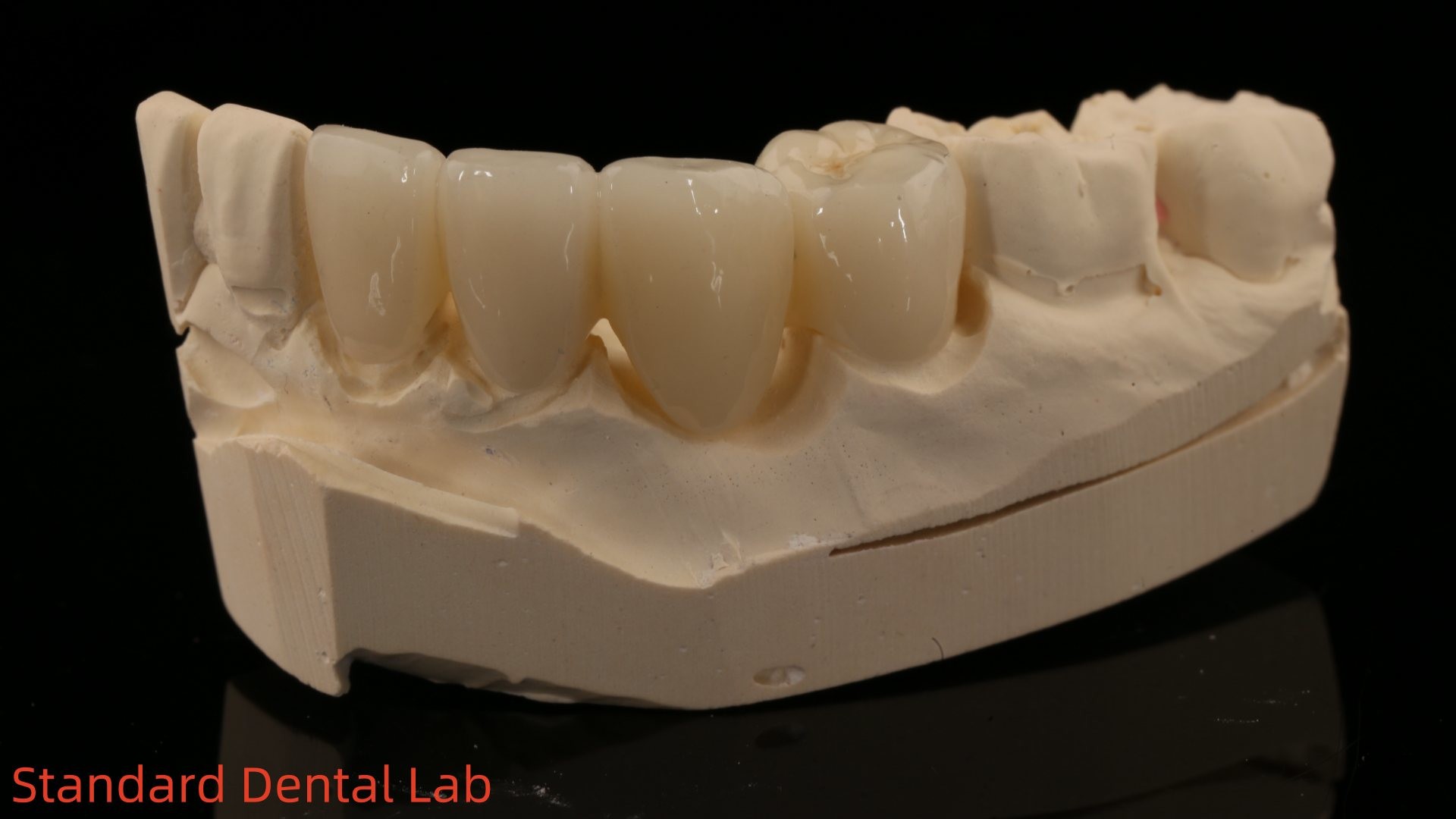 Solid Dental Lab Crowns 3D Pro High Translucency Full Zirconia Crowns with Vita Shade Customized
