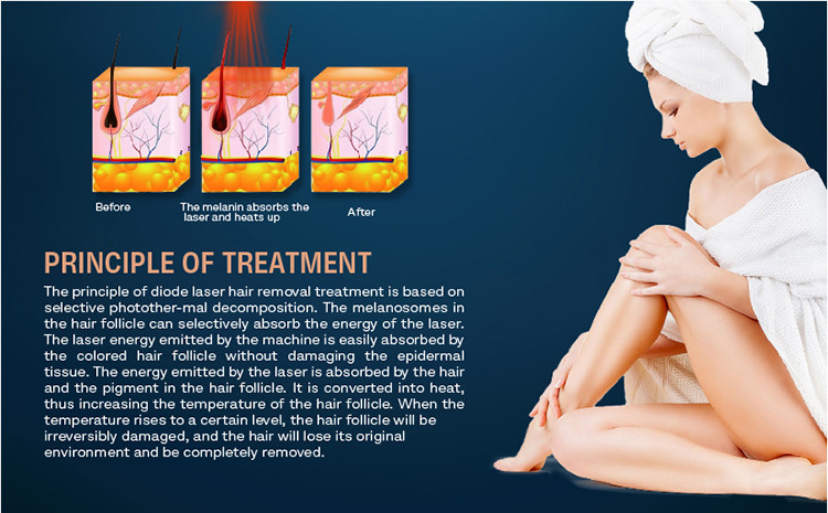 1800W 808nm Diode Laser Hair Removal Machine12 Laser Bar diode ice laser