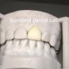 Buy cheap Digital CAD CAM Dental Lab Crowns Translucent Layered Zirconia Crown from wholesalers