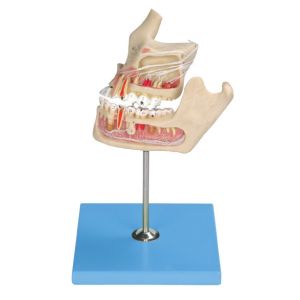  Pathologic Human Teeth Model / Jaw Model with Color Matching by Computer about Two Parts Manufactures