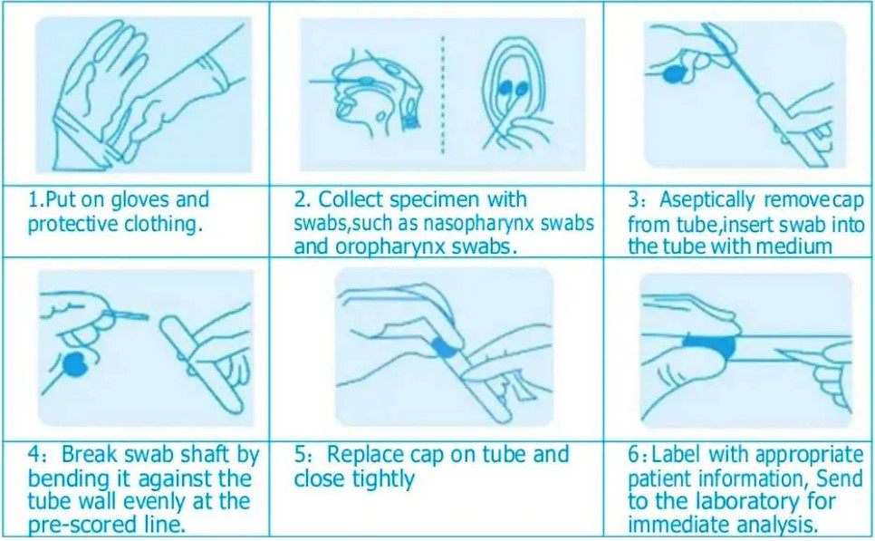 sterile Sampling Swab virus sampling tube with FDA CE certificated