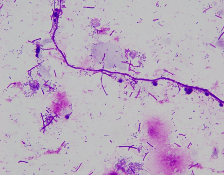Stable Liu's Stain For Auto Stainer Baso Clear Colourful Medical Stains
