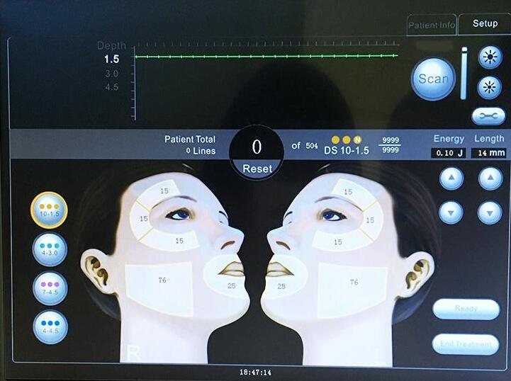 2 In 1 HIFU Body Slimming Machine , Anti Aging HIFU Liposonix Machine