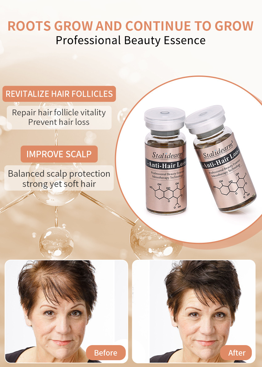 10ml Anti Hair Loss Serum Liquid Set Hair Care Growth Treatment Hair-Loss Prevention Essence