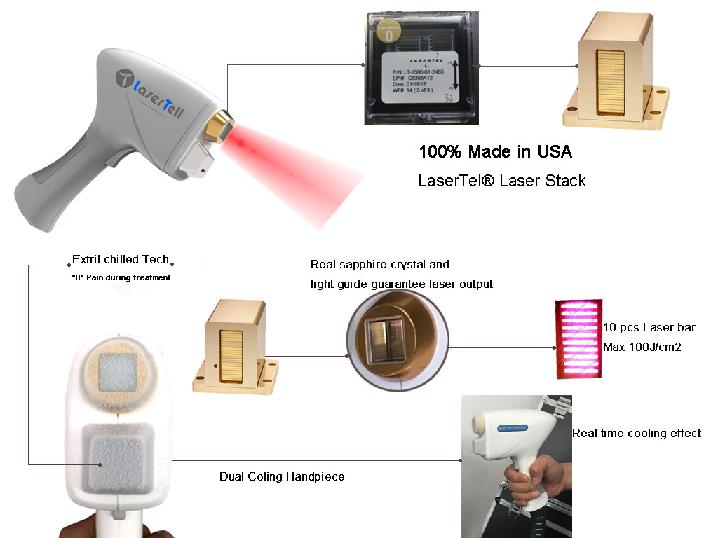 Men 60*50*120cm 50kg 808nm Diode Laser Hair Removal Machine 1-120j/Cm2