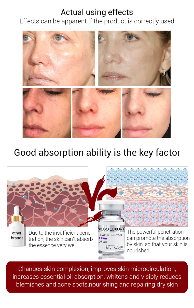 Lightening Firming Meso Serum Microneedling Mesotheraphy Caviar Essence Serum