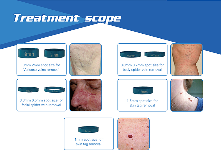 Painfree and Permanent 980nm laser diode laser hair removal machine