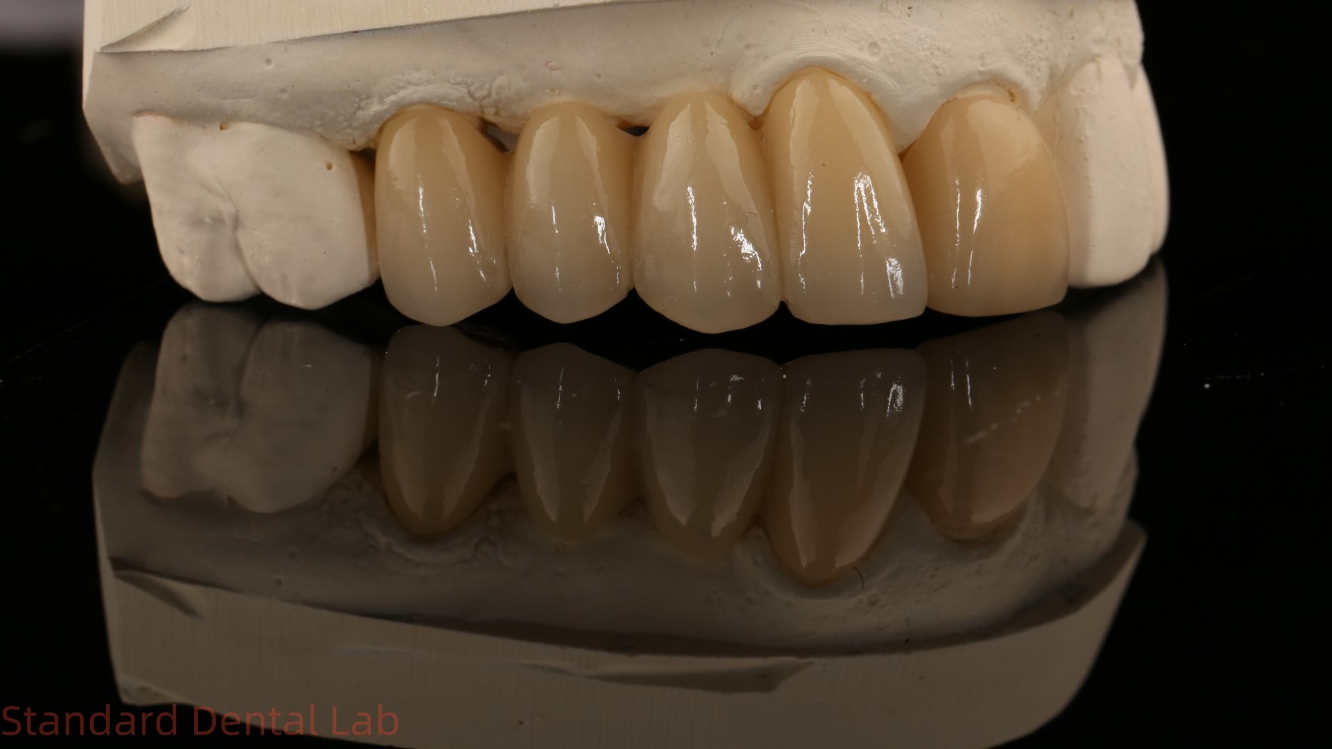 Noritake Porcelian Full Contour Zirconia Crown High Aesthetic Natural Customized Zirconia Dental Bridge
