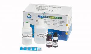 China Serum Assay Anti Mullerian Hormone Test Kit AMH CLIA Kit For Adult Females on sale
