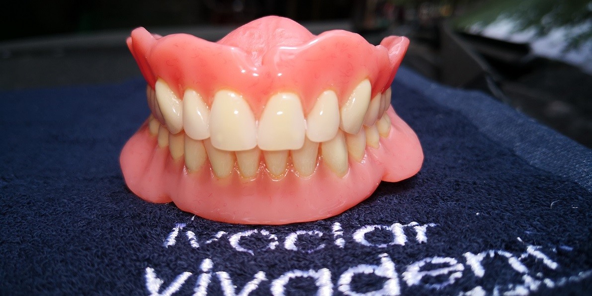 Hot Cured Full Arch Removable Acrylic Full Denture