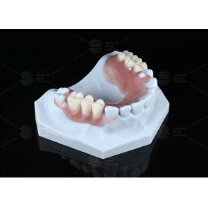 Lightweight Valplast Flexible Partial With Excellent Retention In Pink And