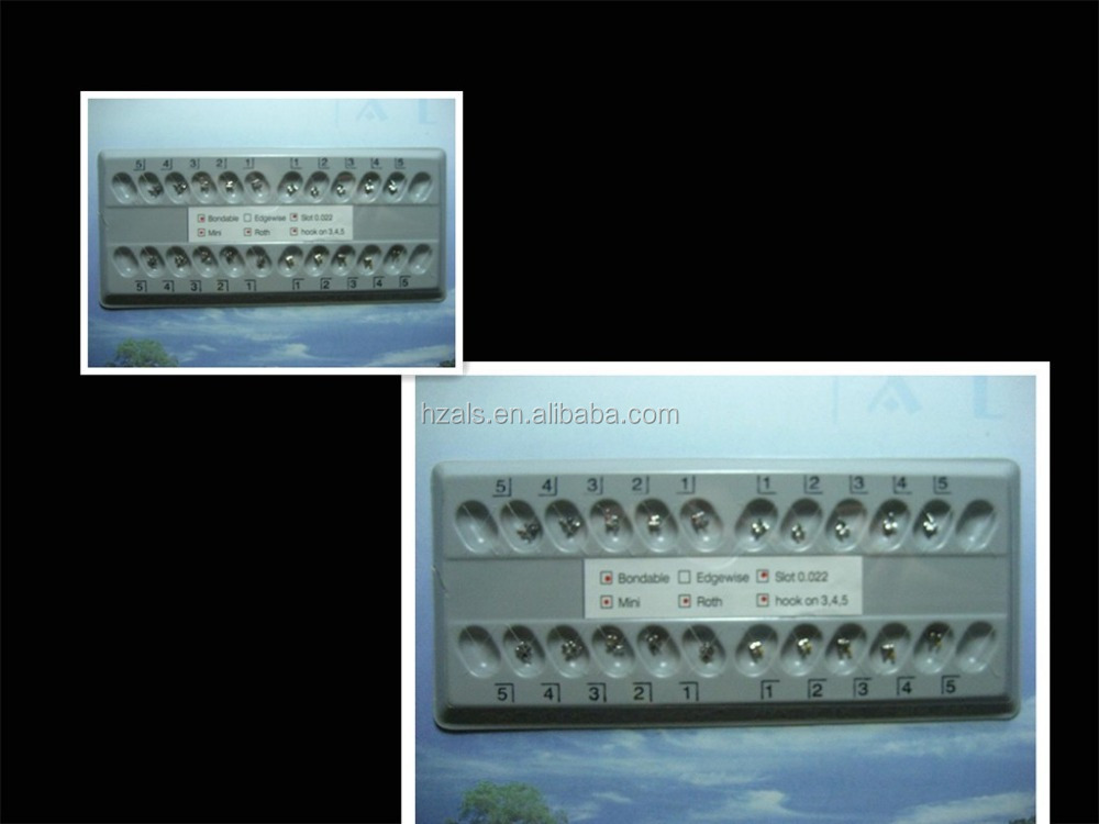 ROTH MBT EDGEWISE Braces The Ultimate Solution for Standard and Mini Orthodontic Treatments