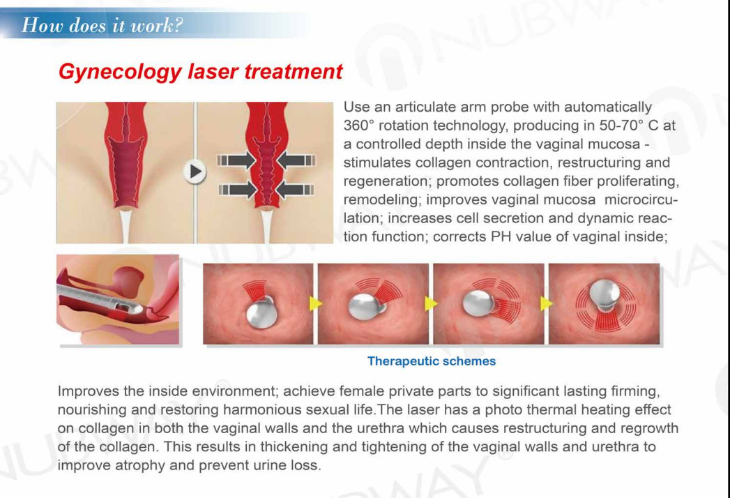 Fractional CO2 Laser Equipment Fractional CO2 Laser Skin Resurfacing