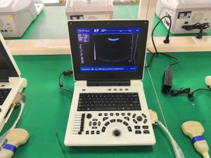  12.1in Tech Diagnostic Ultrasound Scanner Machine Li Battery Manufactures