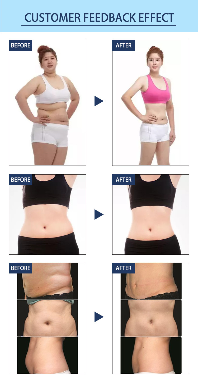LF-251 Portable Mini Cryo Frozen Fat Machine Mini Cryotherapy Pad Frozen Freeze Slimming Cool Fat Machine