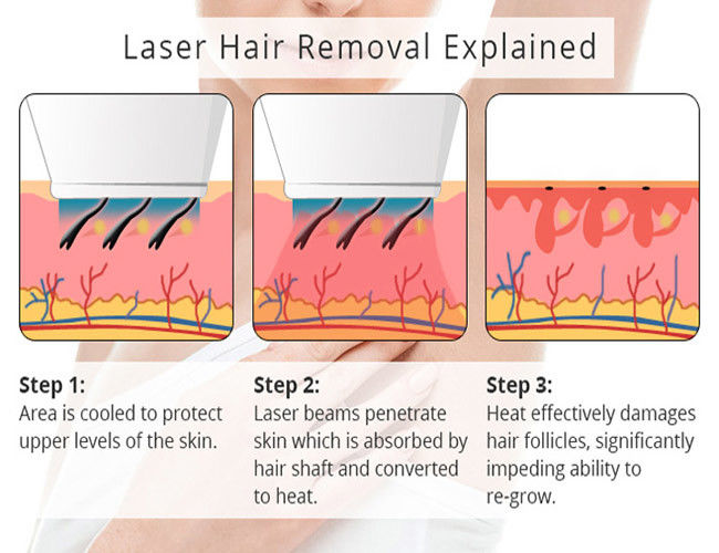 950nm IPL Hair Removal Machine