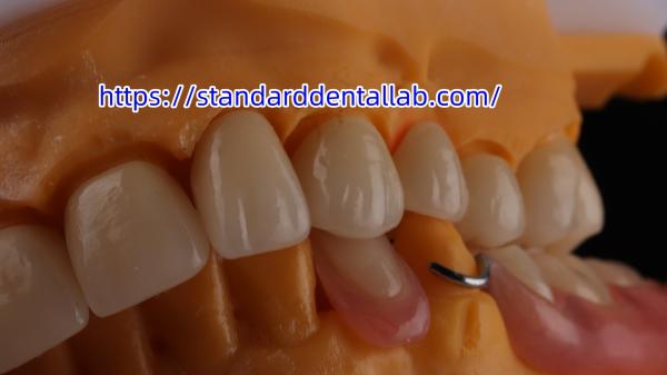 Layered Dental Zirconia Crown And Bridge Translucency 3D PRO Zirconia Porcelain