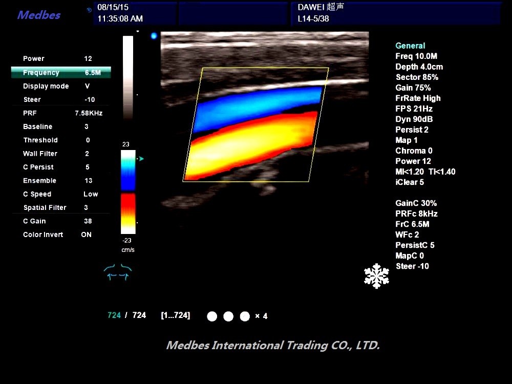 Clinic Ultrasound Scanner M-C60 Portable Color Doppler Ultrasound System