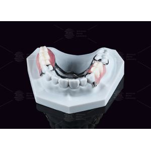 Removable Metal Acrylic Partial Denture With Clasps For Partial Chewing