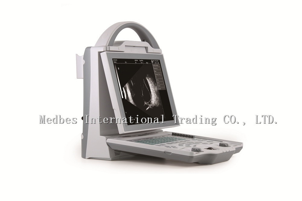 Top Sale Laptop Ophthalmic AB Mode Ultrasound Scanner Equipment