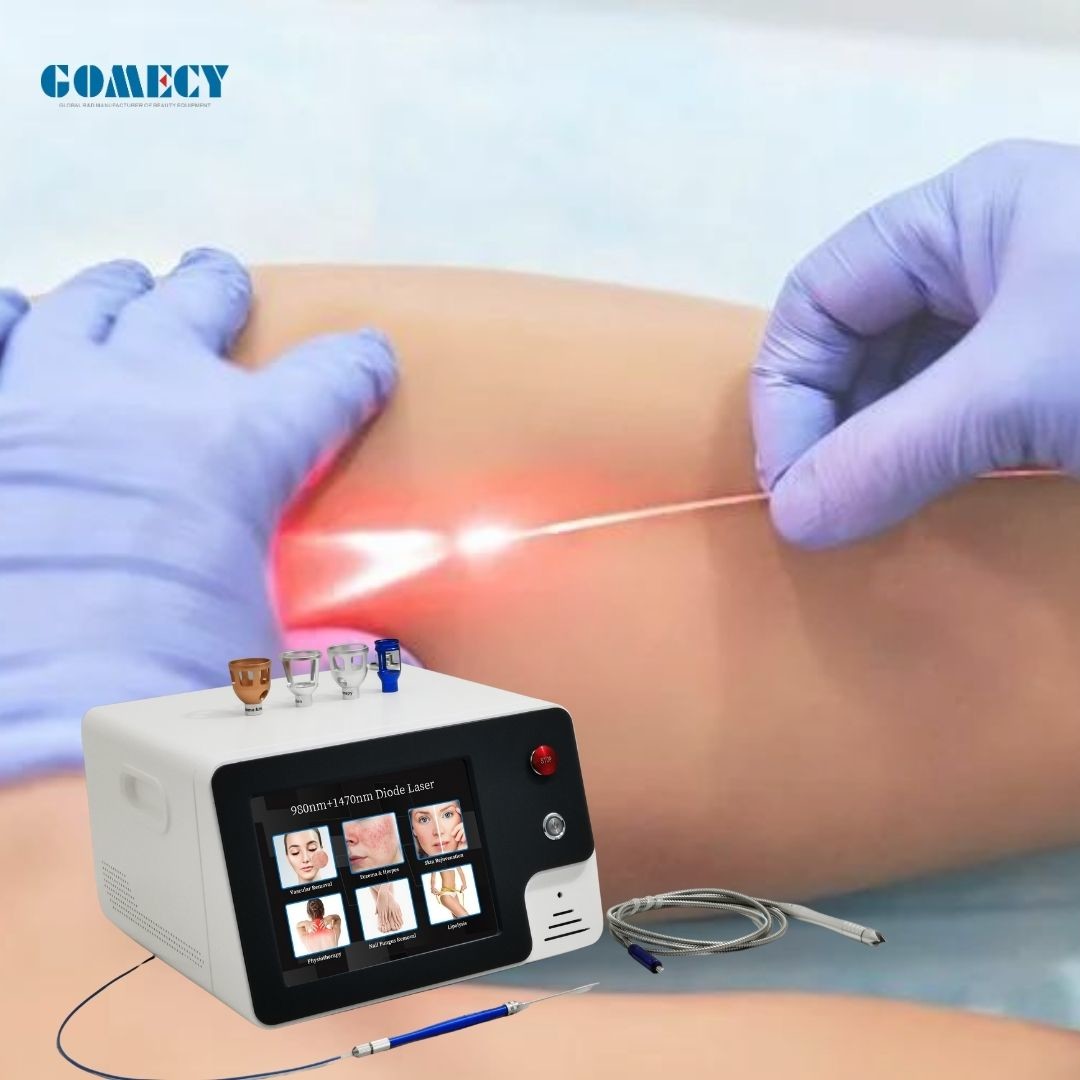 980nm 1470nm Endolift Laser Machine EVLT EVLA Endovenous Vein Laser Ablation For Varicose Vein Removal