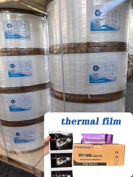 Thermal film Ultrasound Paper Recyclable 75um 95um Thermal Print Film/Media for