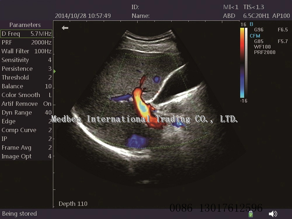 colorful portable veterinary ultrasound popular using in hospital Laptop doppler