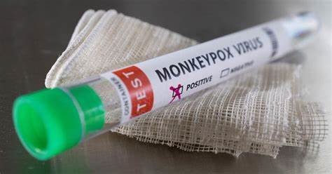 China Monkeypox Virus Detection Reagent Real Time PCR Kit on sale China Monkeypox Virus Detection Reagent Real Time PCR Kit on sale