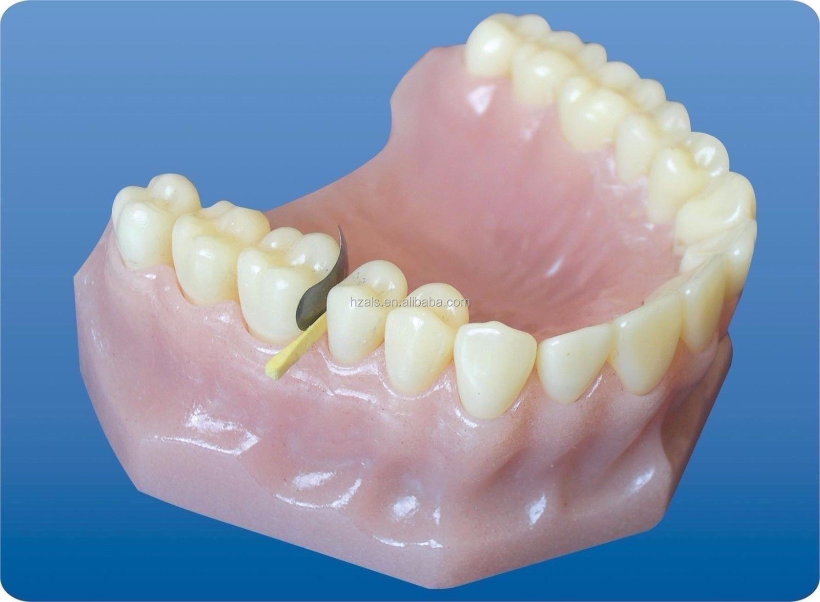 1.298 TOR VM PROFESSIONAL DENTAL Filling Materials Advanced Kit of Sectional Contoured Matrices for MFDS Safety Standard