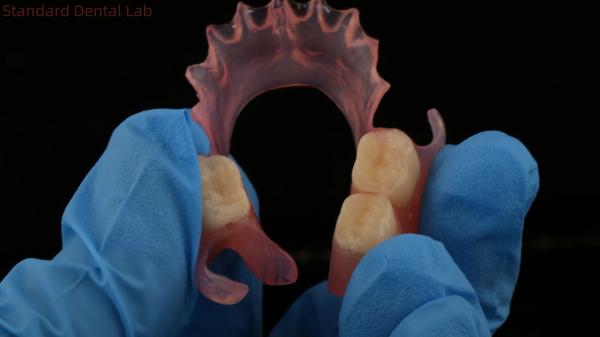 Dental TCS Valplast Flexible Partial Dentures Nesbit Valplast Finish China