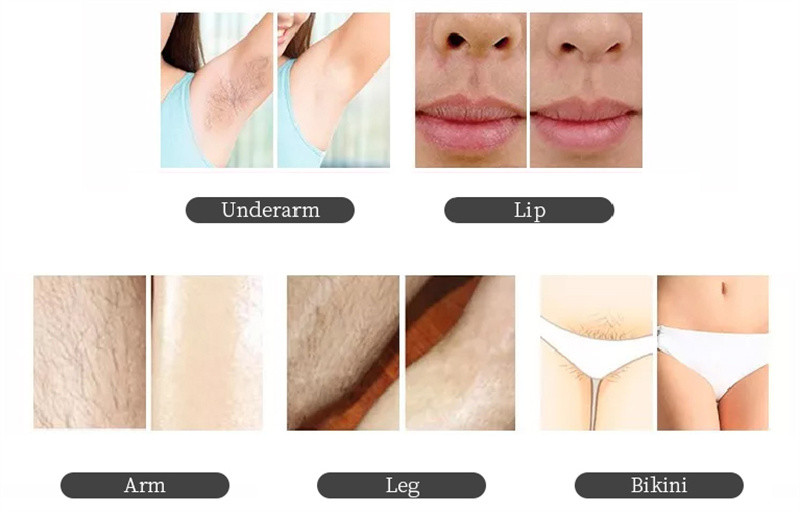 Professional 12*26mm Spot Diode Laser Hair Machine Vertical Style Skin Rejuvenation