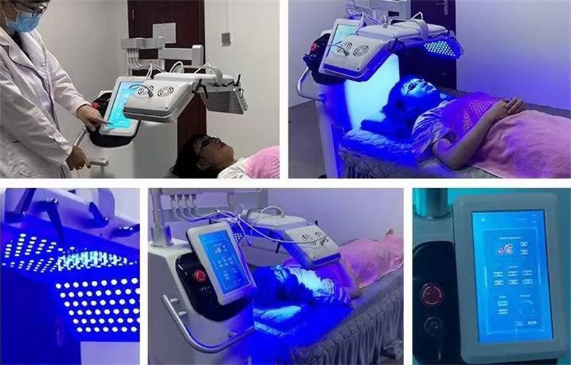 Photodynamic 1000W Pdt Light Therapy Machine Acne Treatment Skincare