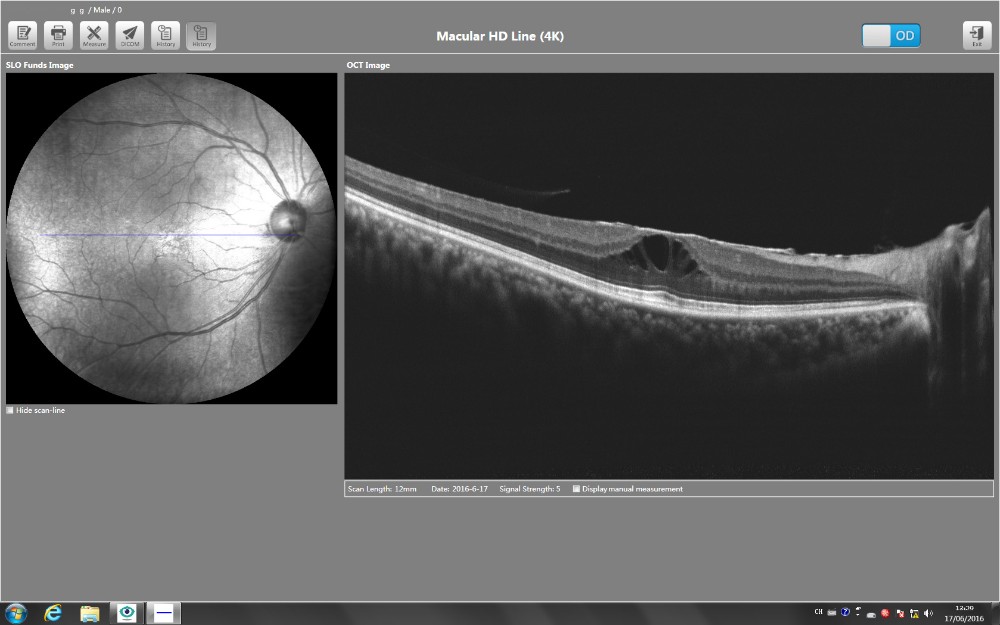 oct machine for eye clinic and hospital Optical Coherence Tomography
