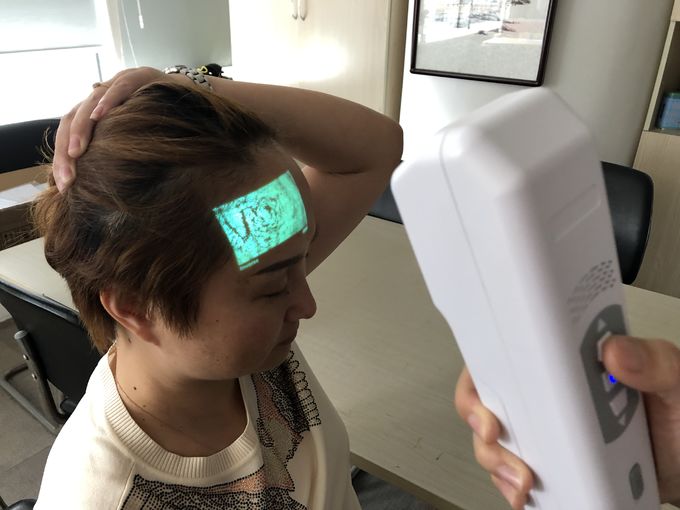 Infrared Wavelengths 850Nm Light  Vein Locator Device Depth of Visible Vein ≤12mm Used For  Micro Plastic Surgery 0
