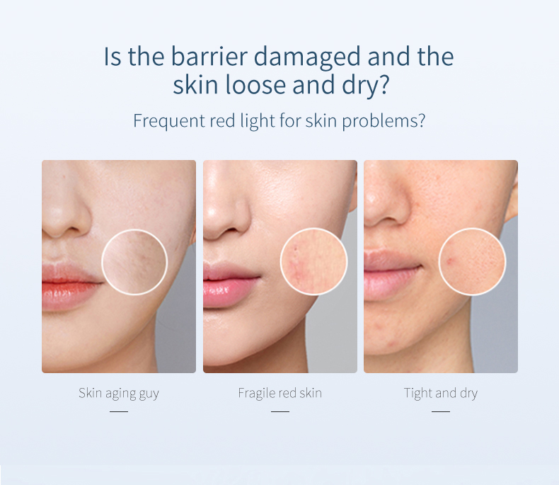 30ml Essence Face Serum 100% Pure Redness Radiant Skin Advanced Rosacea 0