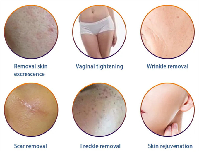 Portable 10600nm Fractional Co2 Laser Machine Scar Acne Removal Beauty