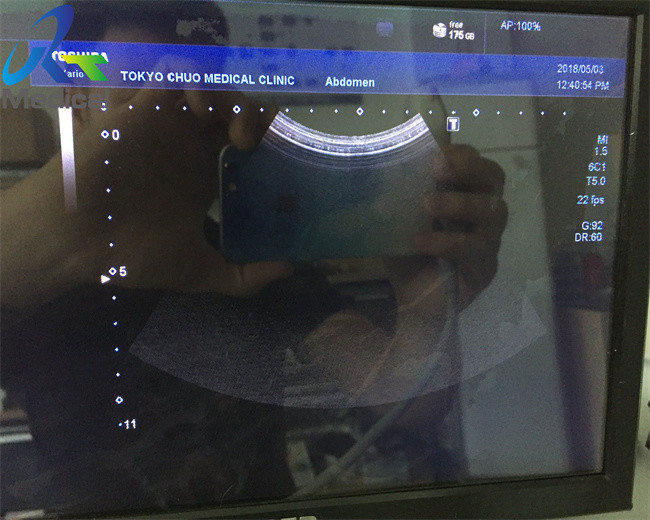 6.0MHz Convex Array Ultrasound Transducer Probe In Hospital Toshiba PVU-375BT