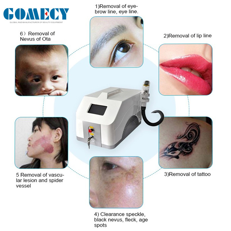1064nm 532nm 1320nm Q Switch Nd YAG Laser Tattoo Removal Machine With Carbon Peeling