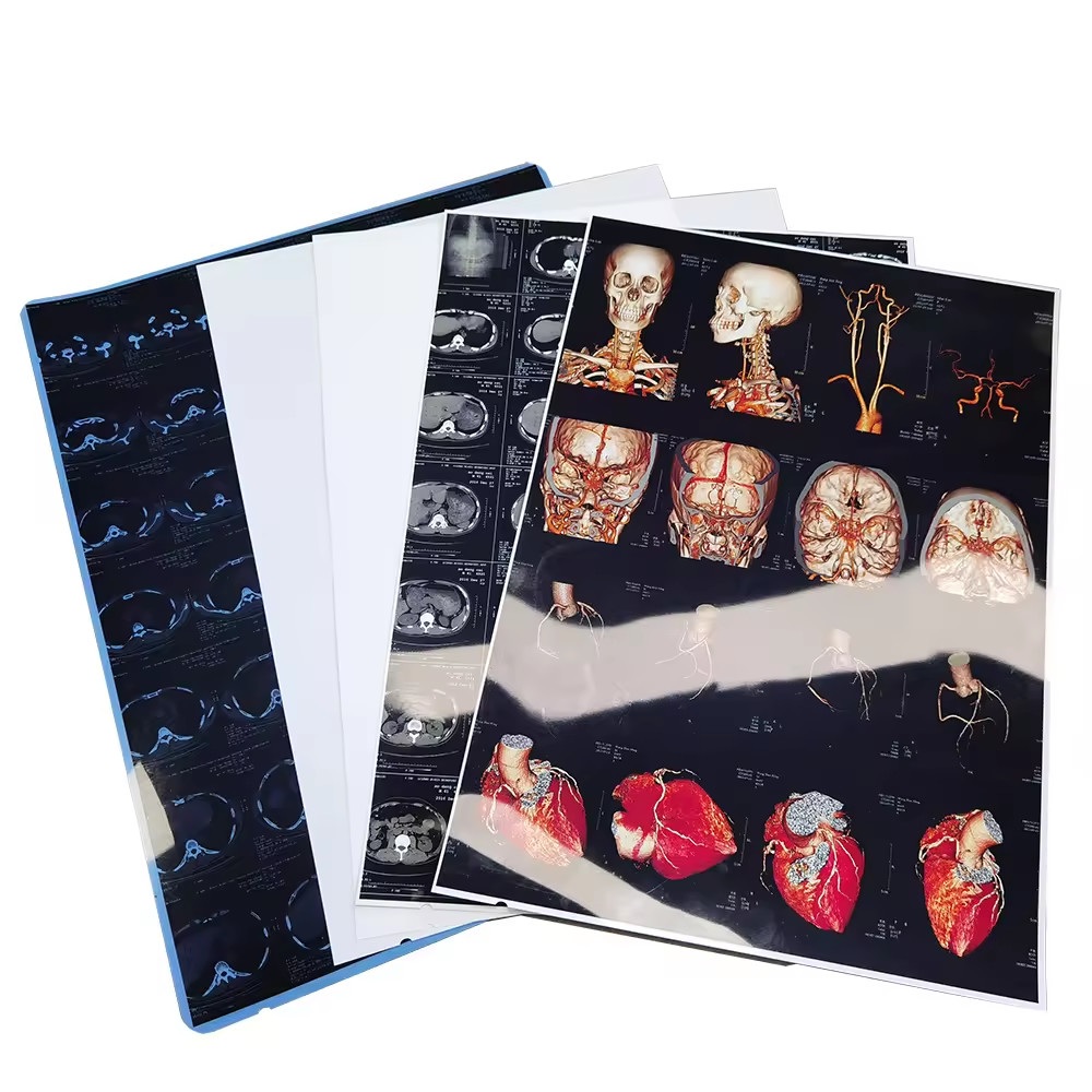 High Resolution Medical Film Inkjet for Clear and Detailed Diagnostic Images