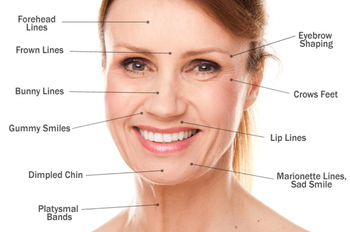 Anti Aging Hyaluronic Acid Wrinkle Fillers Syringe Needle HA Injection Dermal